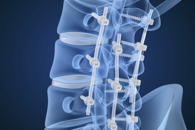 Werkzeugverwaltungssoftware in der Medizin
